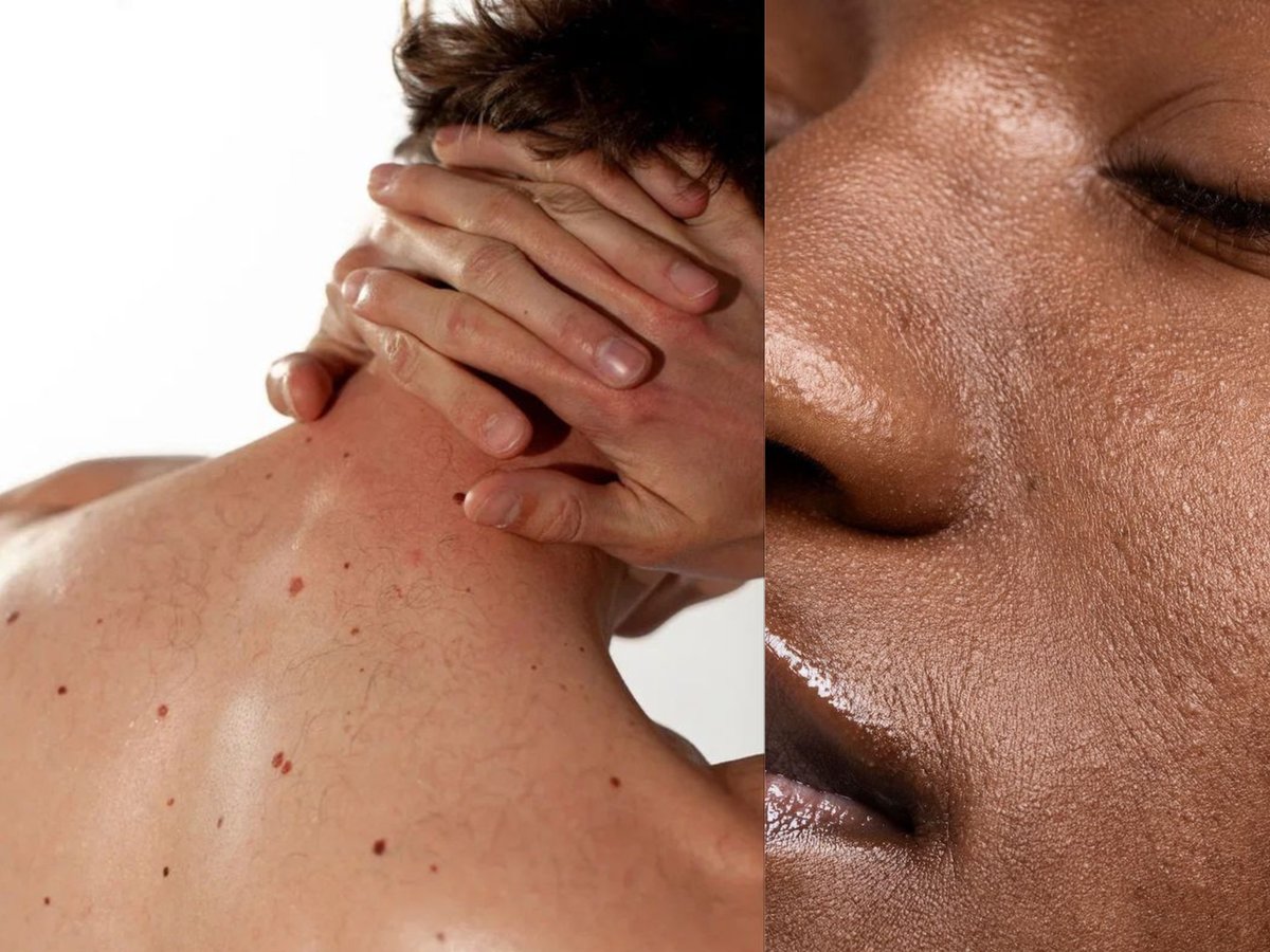 Marks & uneven tone